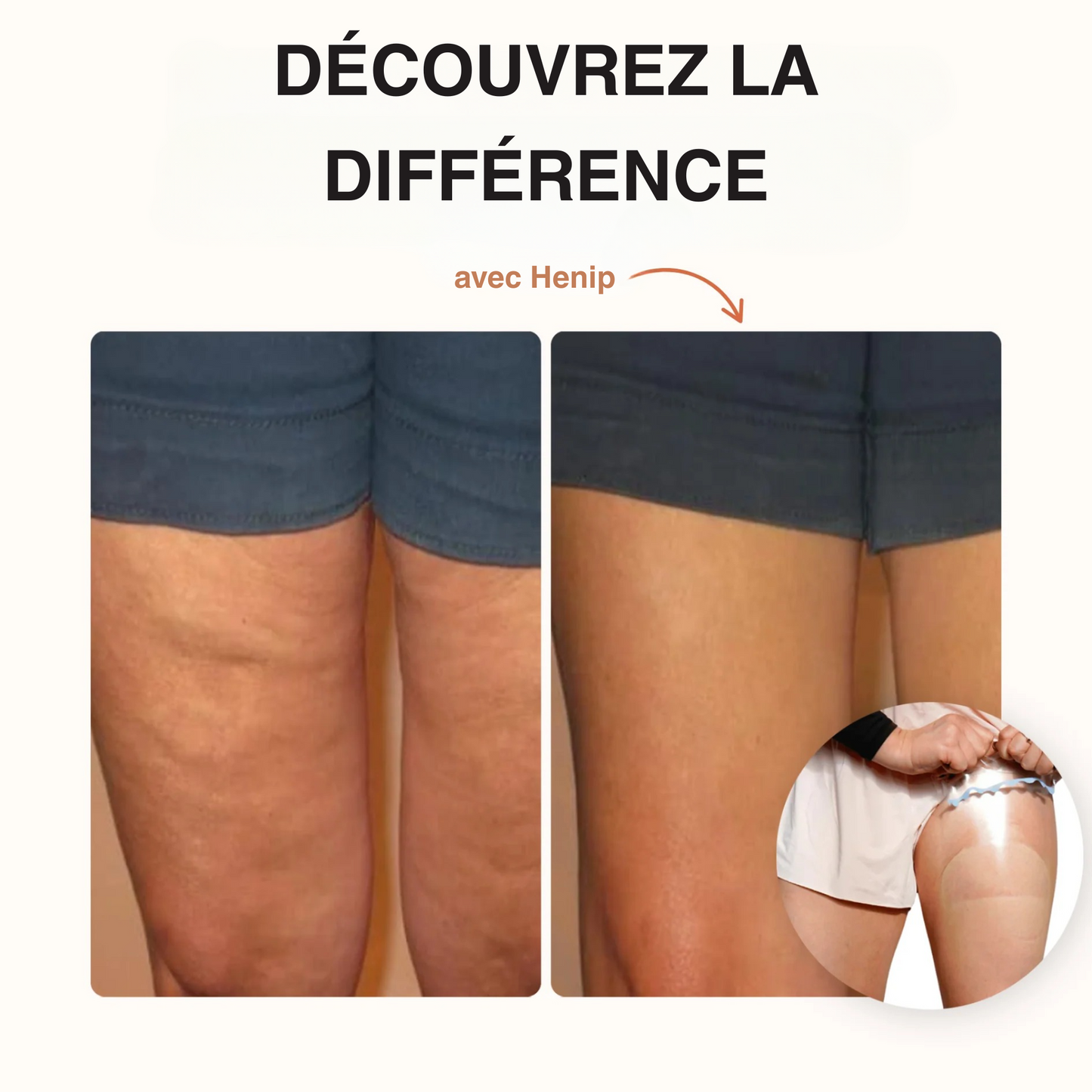 Patch Galbant anti cellulite™