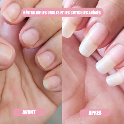 Sérum de Croissance des Ongles | Henip®