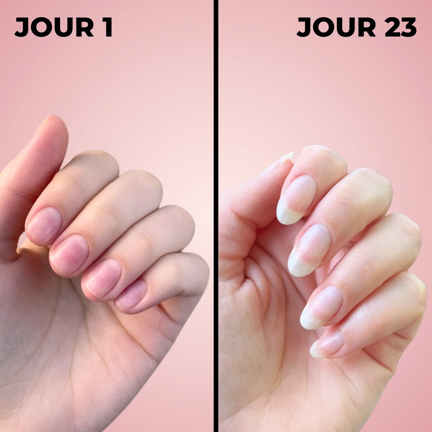 Sérum de Croissance des Ongles | Henip®