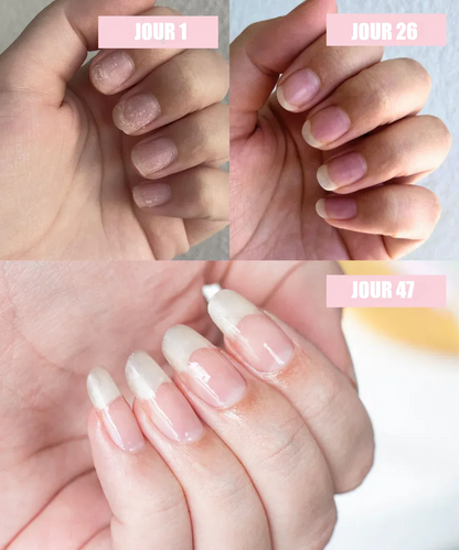 Sérum de Croissance des Ongles | Henip®