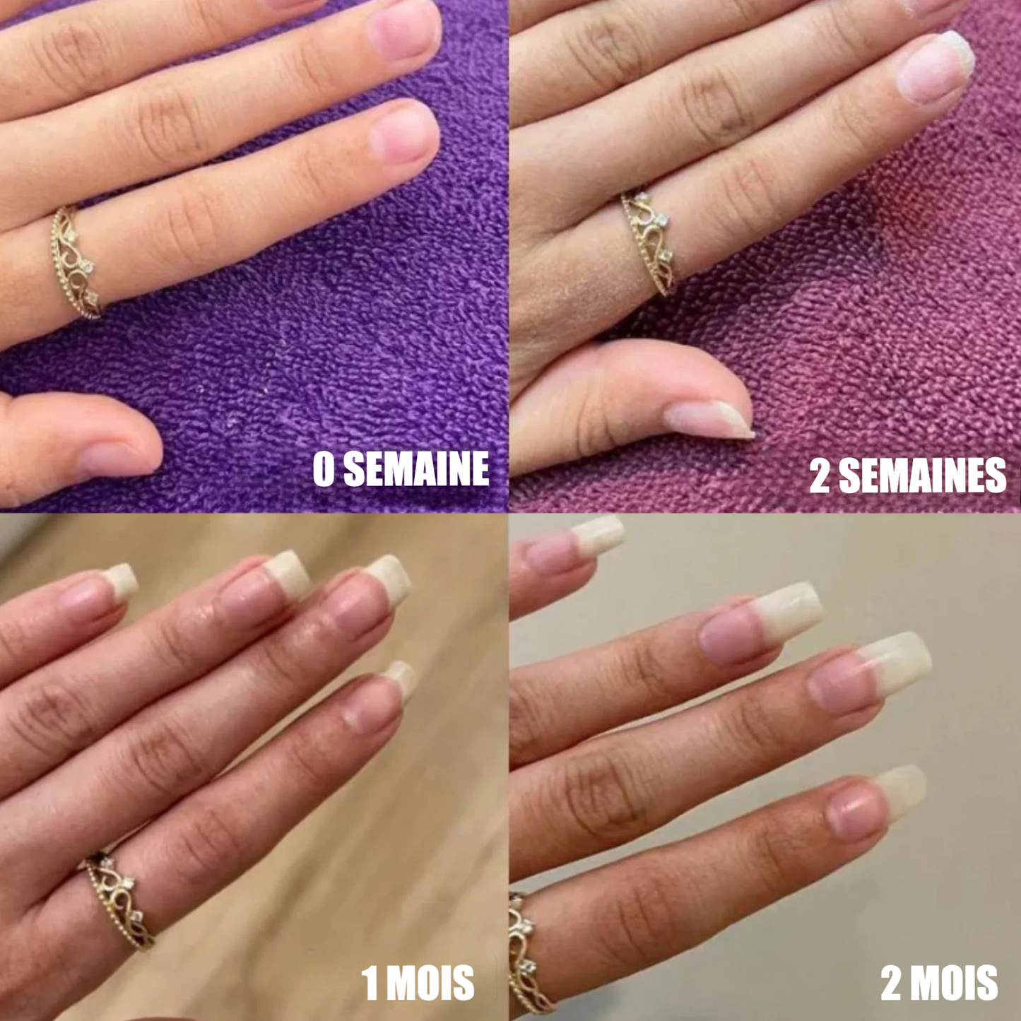 Sérum de Croissance des Ongles | Henip®