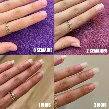 Sérum de Croissance des Ongles | Henip®