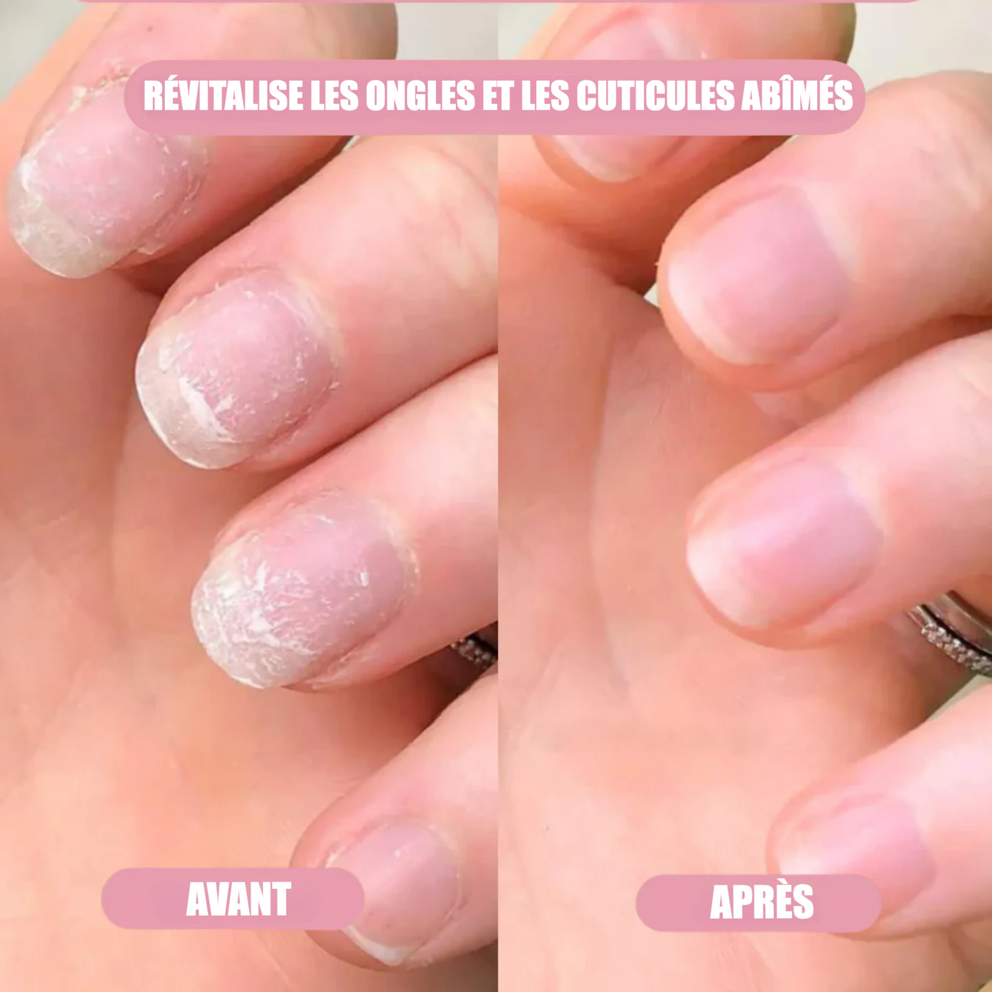 Sérum de Croissance des Ongles | Henip®
